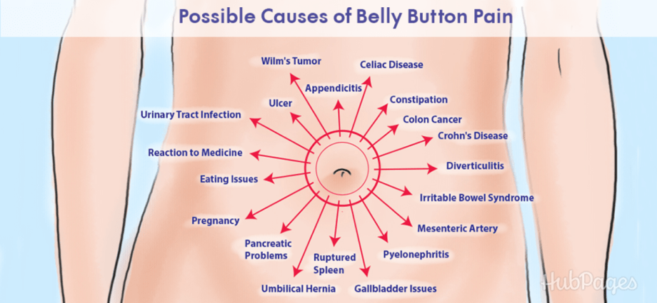 Where does the pain in the navel area come from? Find out the root causes