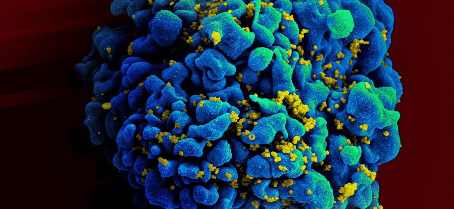 Where is the HIV virus hiding?