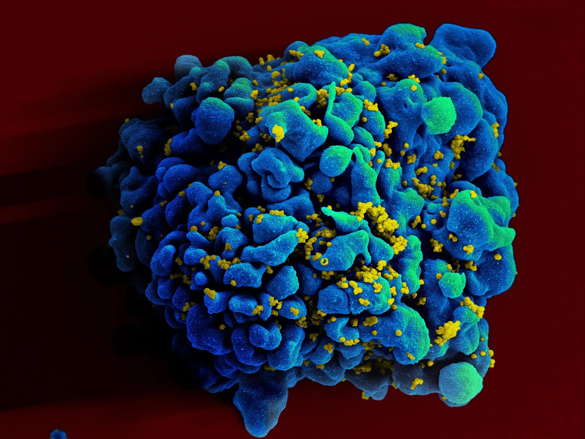 Where is the HIV virus hiding?
