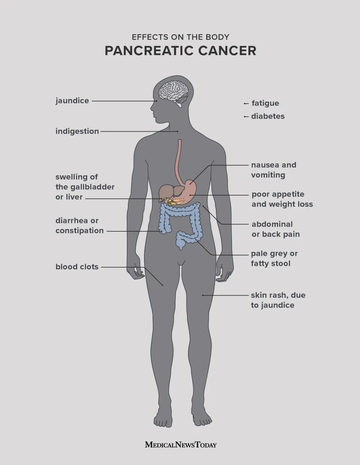 Where is the pancreas? Causes and symptoms of pancreatic diseases