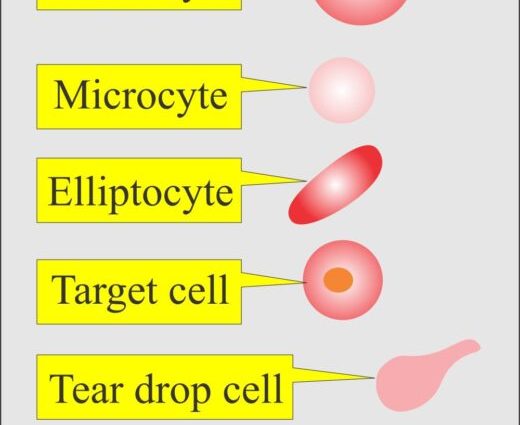 Where to perform a blood count? Morphology at the National Health Fund and in private