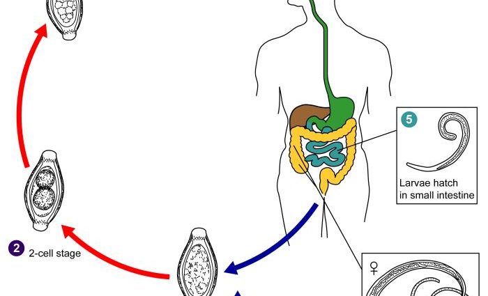 Whipworm (trichuriasis) &#8211; symptoms, treatment and causes