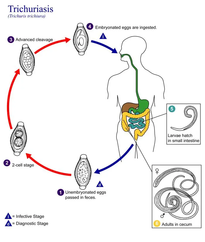 Whipworm (trichuriasis) &#8211; symptoms, treatment and causes