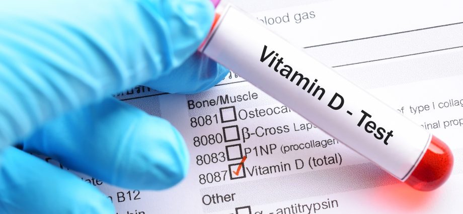 Who should get a vitamin D3 test?