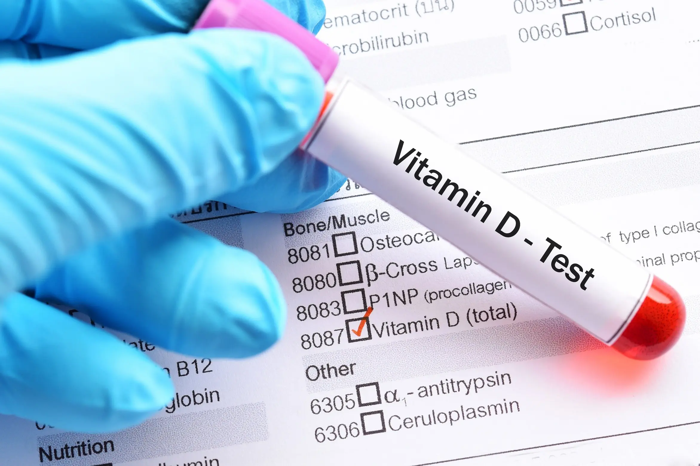 Who should get a vitamin D3 test?