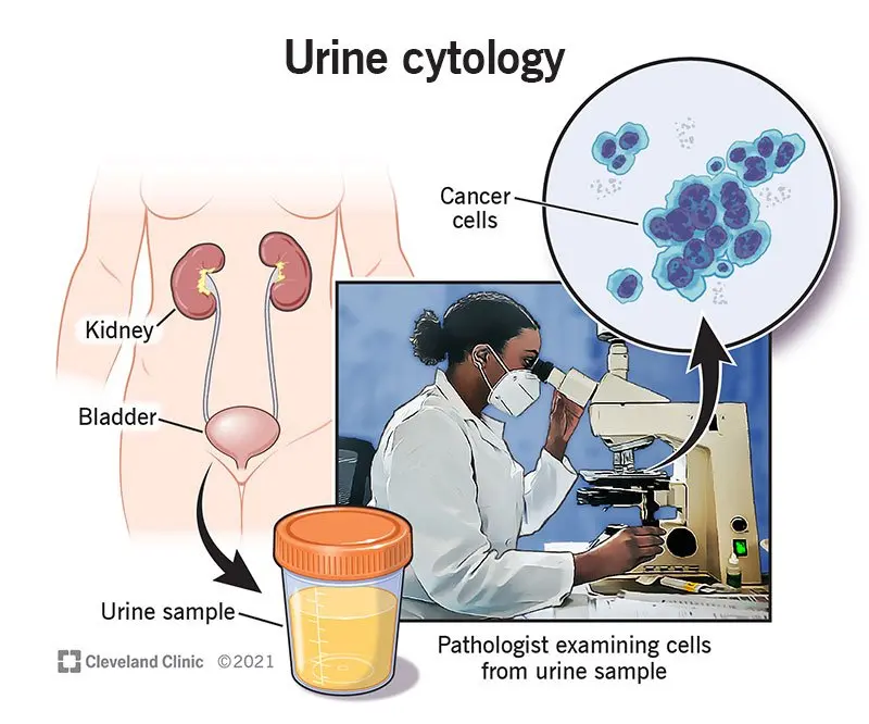 Why are we not doing cytology?