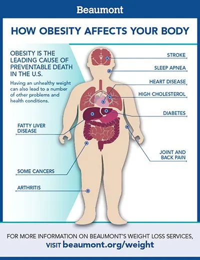 Why do you need to lose weight? These are the diseases that come from obesity