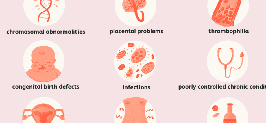 Why does a miscarriage occur? Gynecologist: the problem affects 30% pregnancies