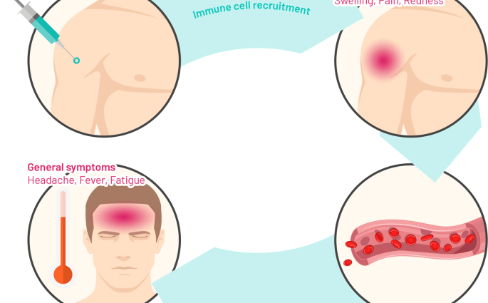 Why does the arm hurt after the COVID-19 vaccine? This is the most common post-vaccination reaction