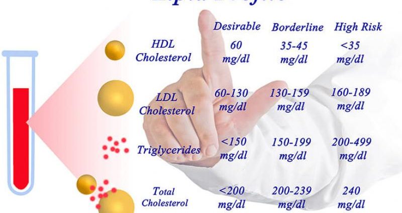 Why is it worth taking a lipid profile?