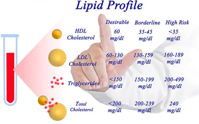 Why is it worth taking a lipid profile?