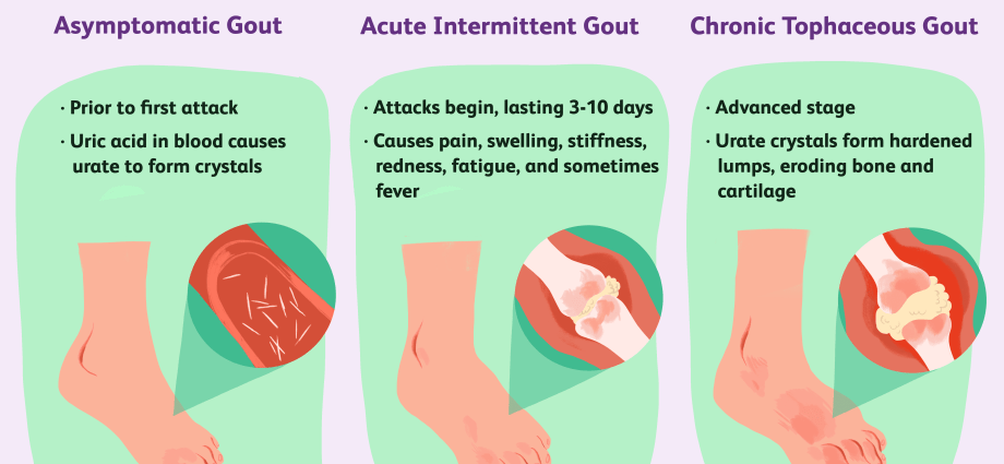 Why is uric acid worth testing?