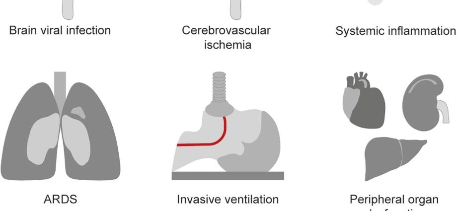 &#8220;Will there be a wave of COVID-19 related memory impairment and dementia in the future?&#8221;