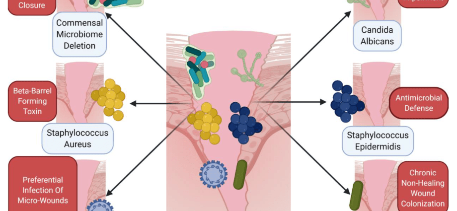 Wounds heal badly because RNA gets in the way