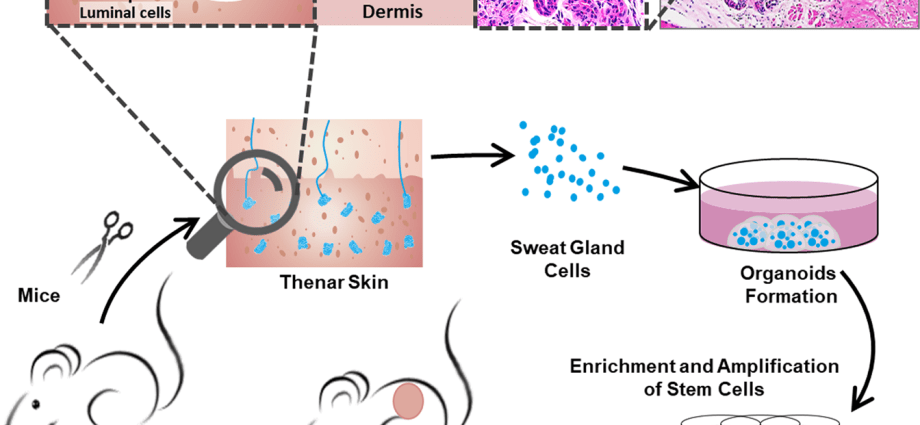 Wounds heal thanks to the sweat glands