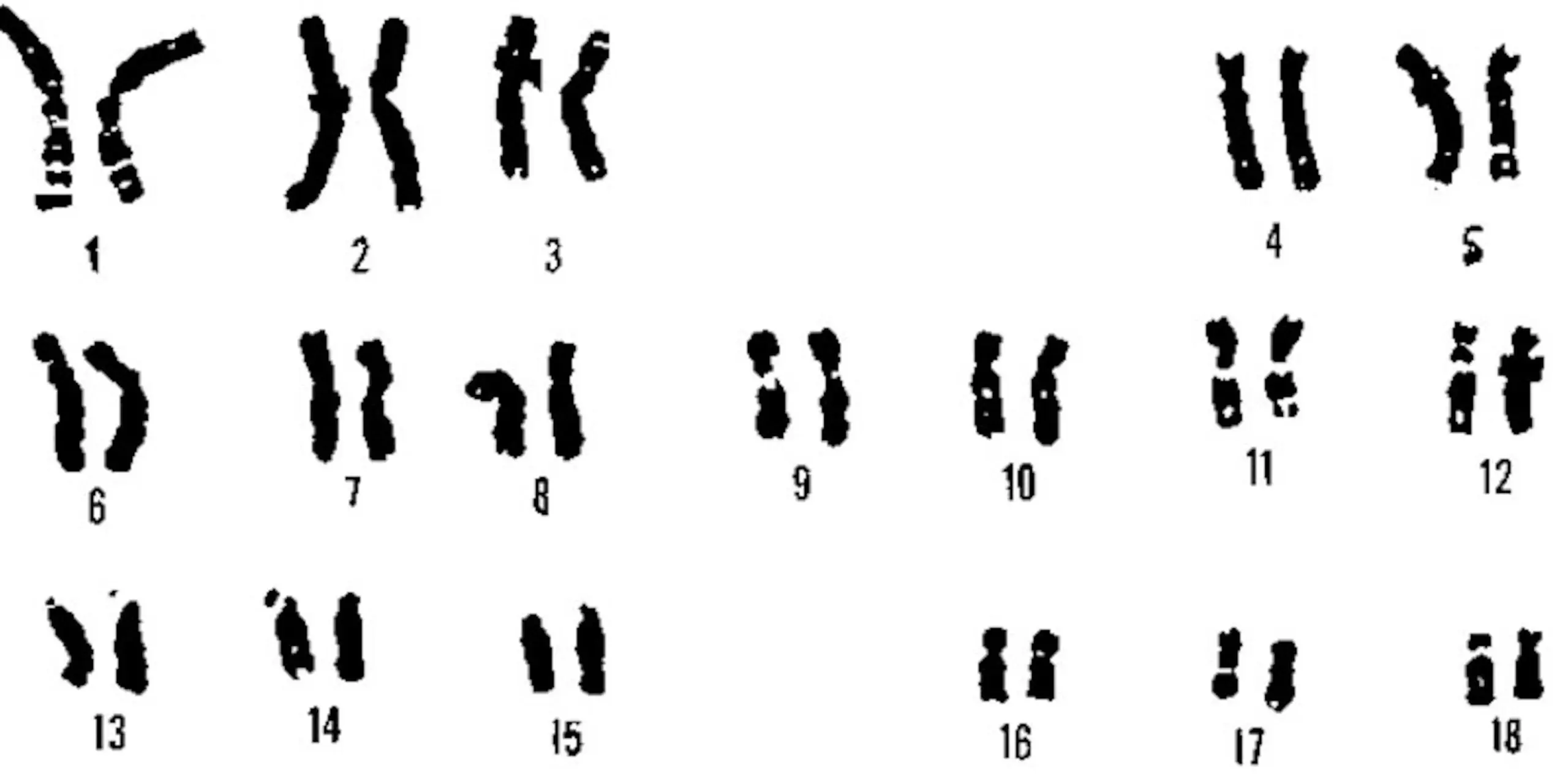 You can turn off the chromosome responsible for Down&#8217;s syndrome