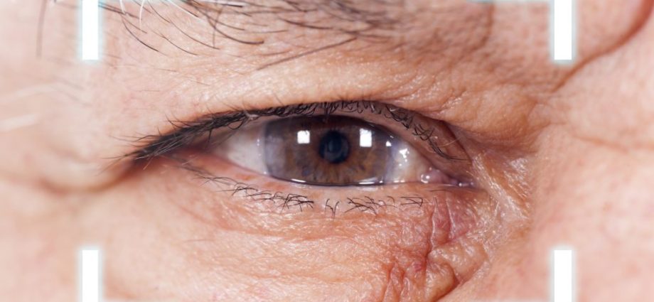 You have a cataract? The best time to treat her is right now!