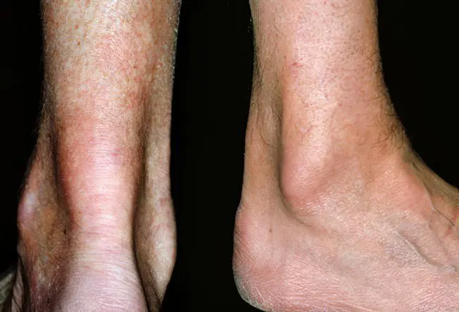 15 Causes of Foot Pain in Adults