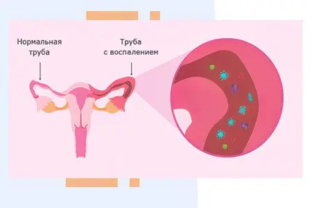 25 causes of back pain in women and men