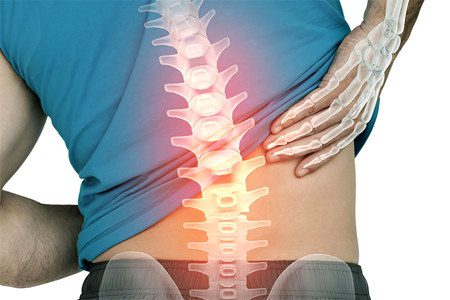 25 causes of back pain in women and men