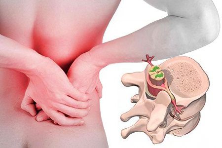 25 causes of back pain in women and men