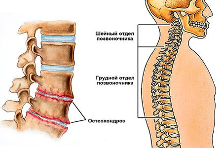 25 causes of back pain in women and men