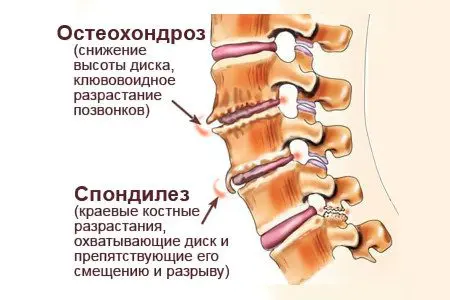 25 causes of back pain in women and men