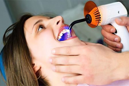 7 modern methods of dental treatment without pain