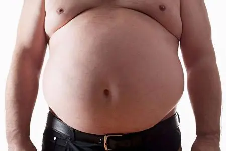 abdominal obesity