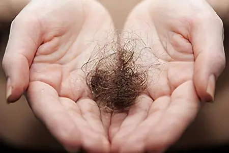 Alopecia areata in children and adults