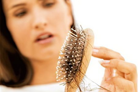 Alopecia (baldness) in women