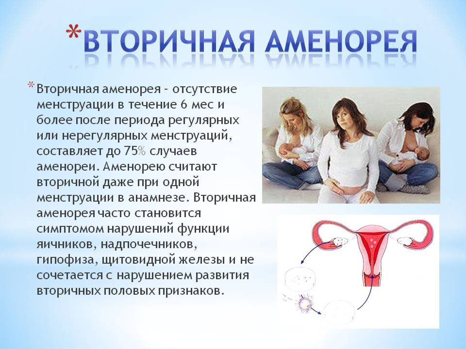 Amenorrhea primary and secondary: causes and treatment