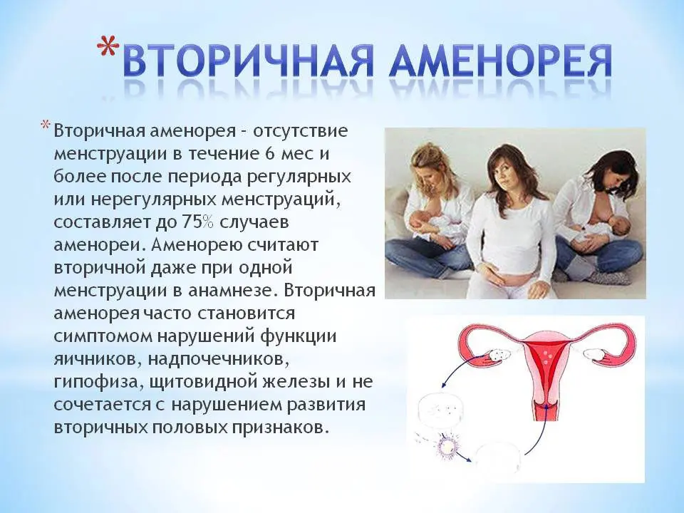 Amenorrhea primary and secondary: causes and treatment