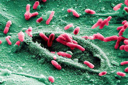 Analysis of feces for dysbacteriosis: interpretation of the results