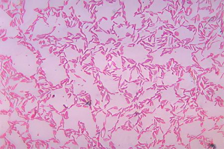 Analysis of feces for dysbacteriosis: interpretation of the results