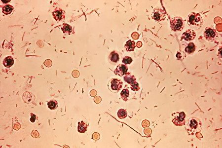 Analysis of feces for dysbacteriosis: interpretation of the results