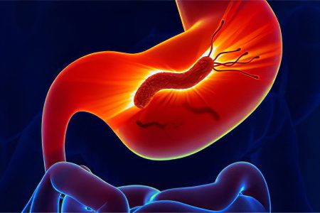 Analysis of Helicobacter pylori