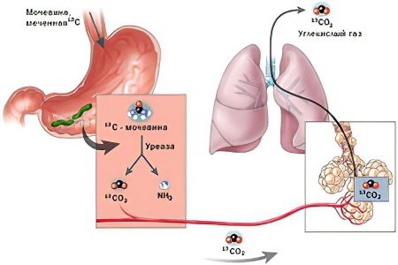 Analysis of Helicobacter pylori