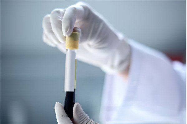 Analysis of thyroid hormones (normal levels of TSH and T4 hormones)