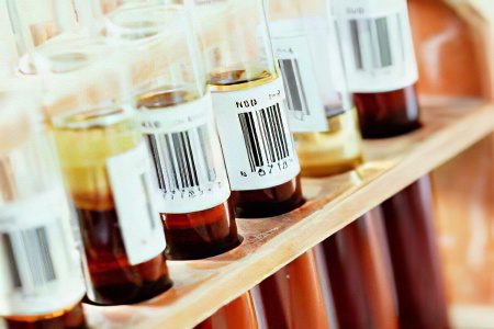 Analysis of thyroid hormones (normal levels of TSH and T4 hormones)