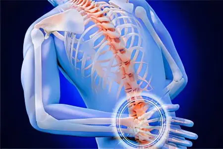 Ankylosing spondylitis: symptoms and treatment