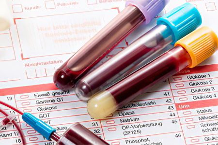 Antithrombin III - what is it?