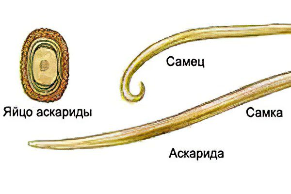 Ascariasis in children