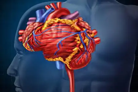 Atherosclerosis of the brachiocephalic arteries