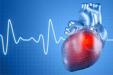 Atrial fibrillation: causes, symptoms and treatment