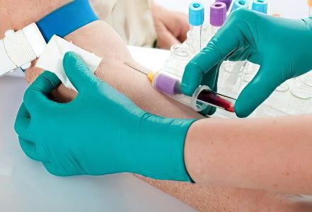 Blood test for HIV and hepatitis