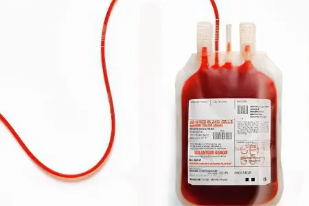 Blood transfusion: complications, indications, preparation