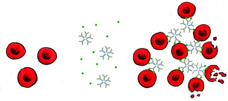 Blood transfusion: complications, indications, preparation