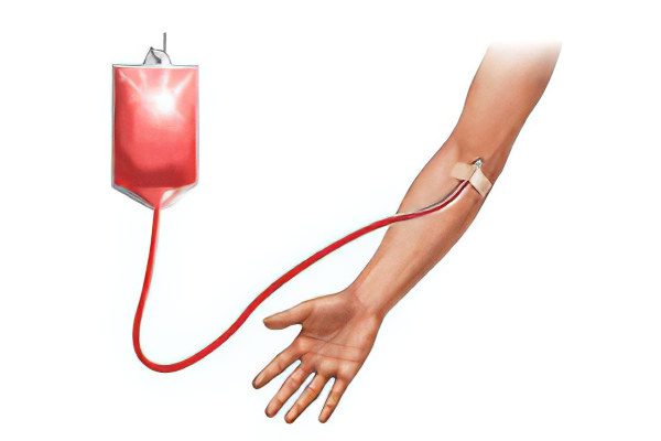 Blood transfusion: complications, indications, preparation