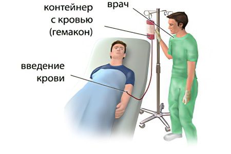 Blood transfusion: complications, indications, preparation